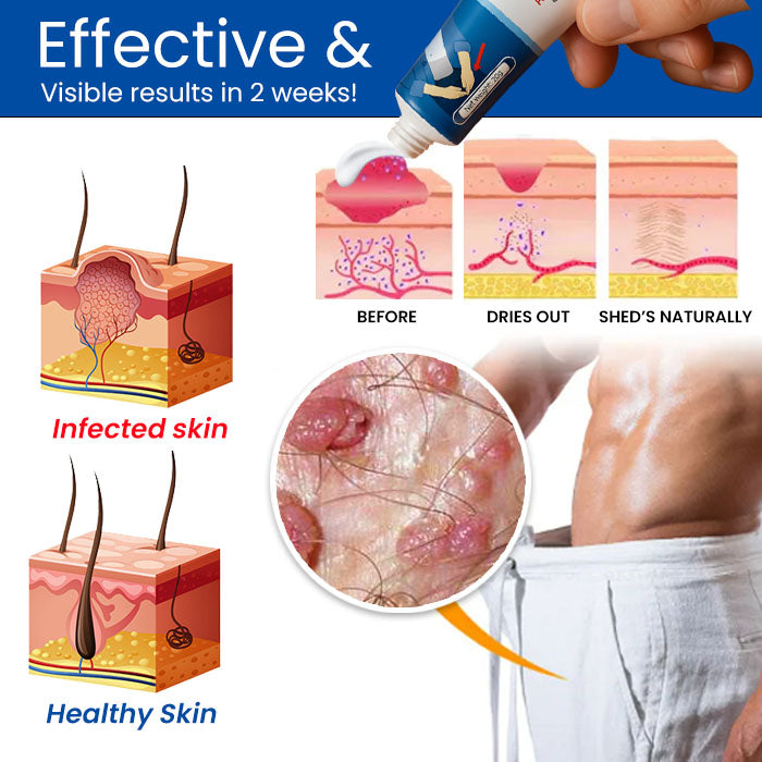 GentX Relief Cream